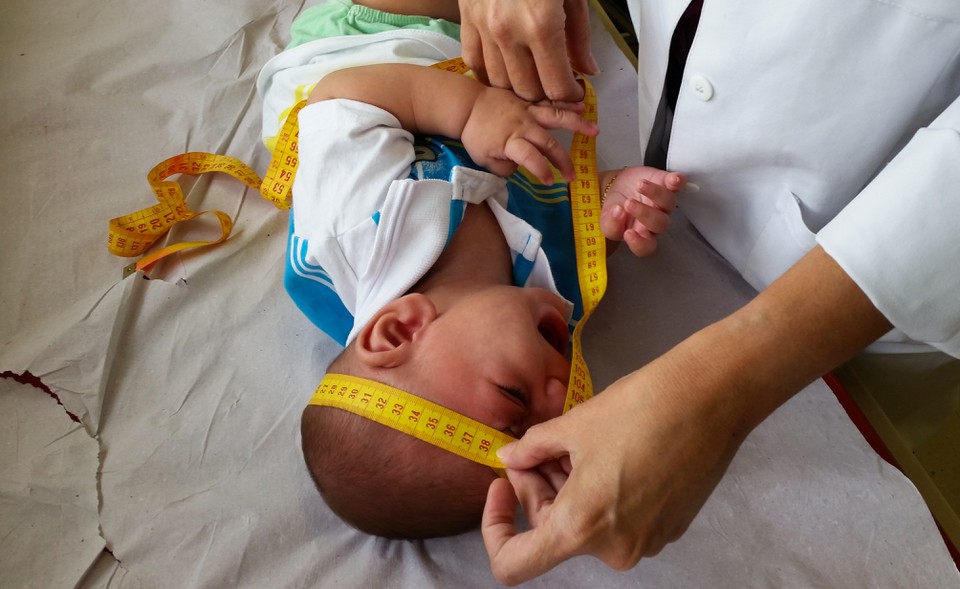  Os pacientes que sero beneficiados com o servio possuem m formaes ortopdicas graves causadas pela sndrome congnita do zika vrus (Foto: Sumaia Villela/Agncia Brasil)