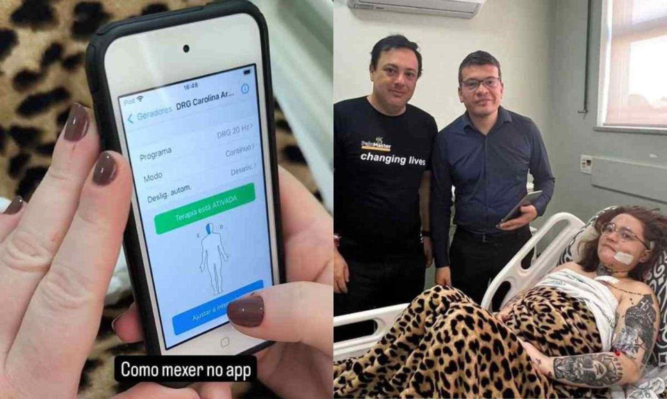 Carolina Arruda realizou cirurgia para implantar neuroestimuladores que podem ser controlados pela prpria paciente em momentos de crise (foto: Redes sociais/Reproduo)