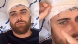 Em vdeo publicado nas redes sociais, o artista mostra um corte na teste ocasionado pelo acidente 