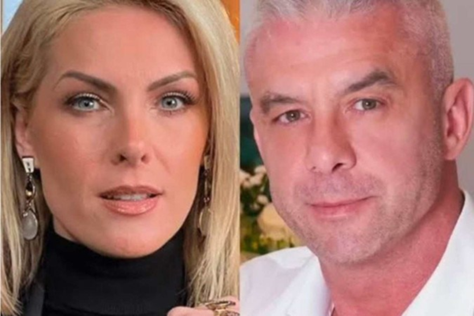 Horas antes do post de Alexandre, Ana Hickmann mostrou pela primeira vez fotos das agresses que sofreu do ex-marido  (Crdito: Instagram)