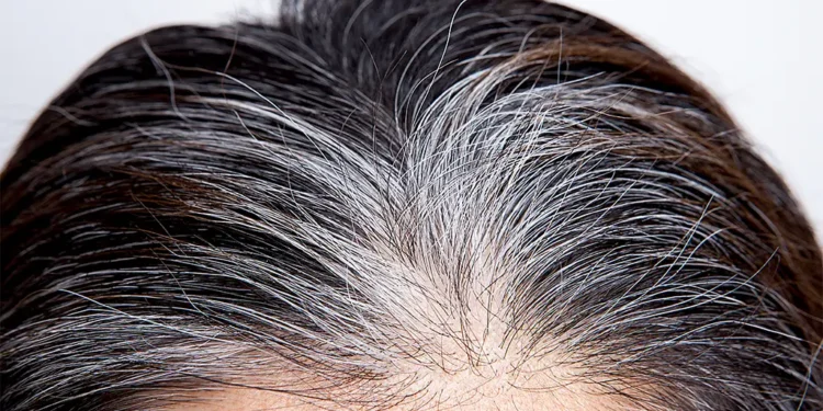 Brasileiros descobrem forma de dar fim aos cabelos brancos gastando R$ 40