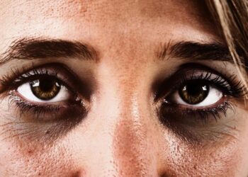 Creme caseiro e fácil de fazer acaba ligeirinho com olheiras