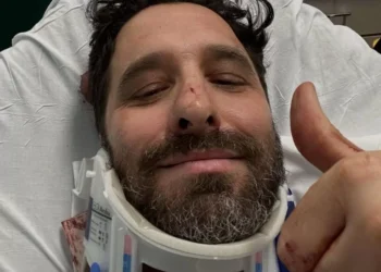 Rafinha Bastos sofreu acidente nos EUA e fratura foi confirmada