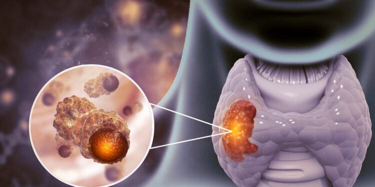 Ídolo do Flamengo que joga muito acabou de ser diagnosticado com câncer