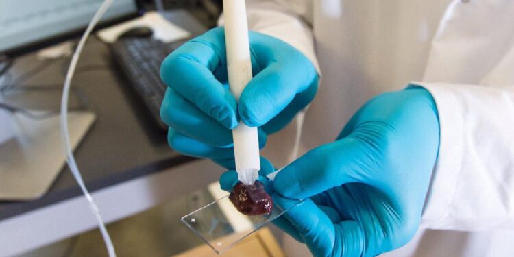 Qual a caneta que antecipa diagnóstico de câncer e chegou ao Brasil? Vai salvar vidas!