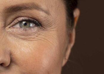 Ingredientes de fácil acesso acabam imediatamente com as rugas