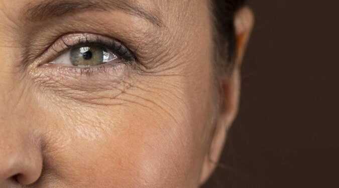 Ingredientes de fácil acesso acabam imediatamente com as rugas