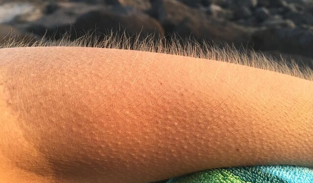 O que são aqueles arrepios estranhos que sentimos na cabeça?