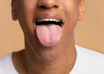 Língua na cor branca significa mau cuidado? Entenda como solucionar