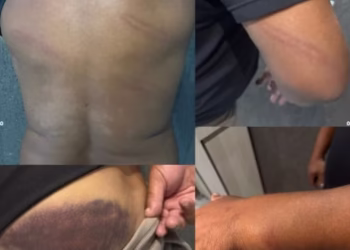 Ex-jogador campeão do mundo foi agredido pela Polícia e motivo é surpreendente