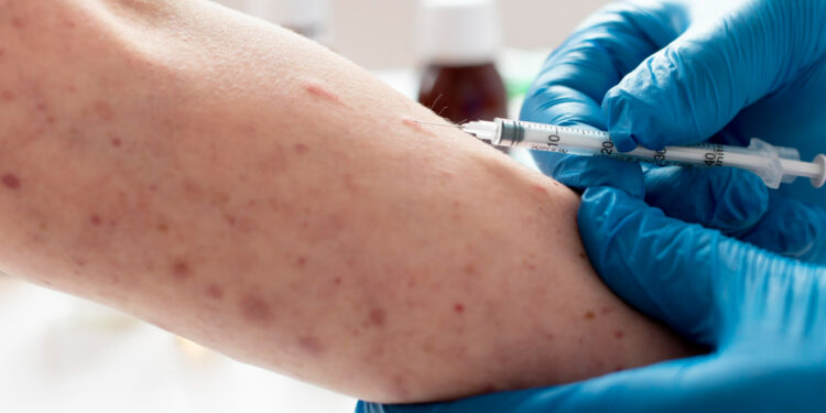 Comunicado geral do Ministério da Saúde sobre vírus mpox