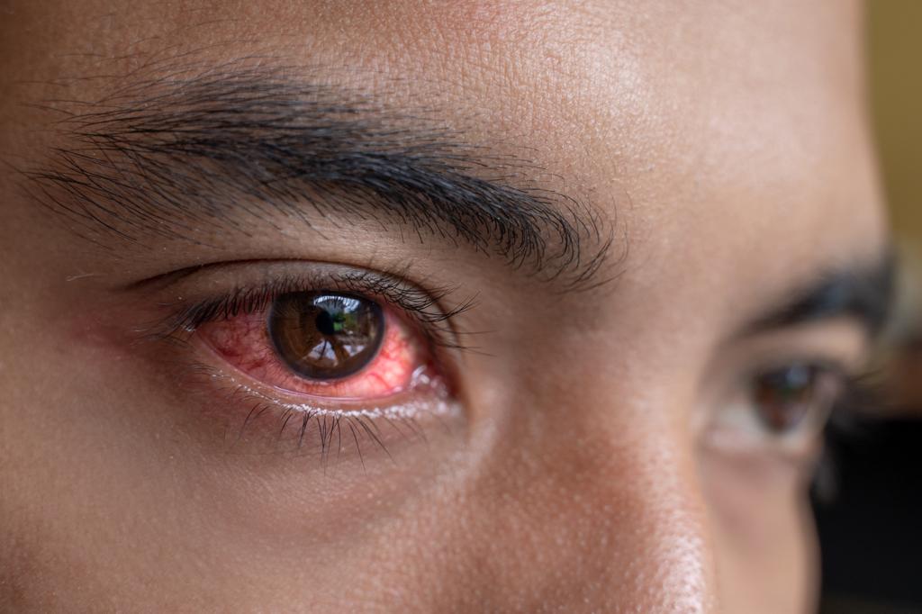 Olhos Inchados potenciais causas